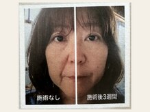 ジュビル(JUBIL)