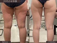 「何をしても痩せない」「頑張っているのに変わらない」【くびれ/下腹部/二の腕/太もも/お尻】