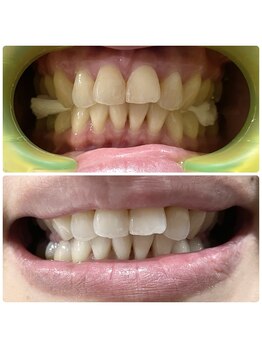 ワイズサロン(Y's salon)/ご新規様の症例写真です!