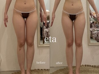 エタ(eta)/下半身太りのお悩みの方向け