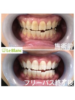 ルブラン 奈良店(Le Blanc)/喜んで頂きました(^ ^)