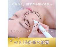 テセラ(Tethere)
