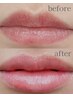 【ローマピンク★無料相談】当日施術OK♪くすんだ"唇"を赤ちゃんピンクに