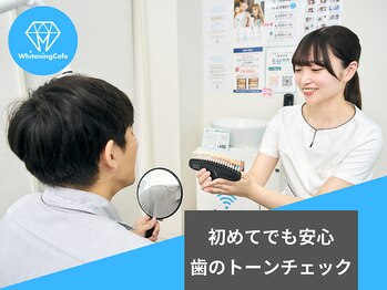 ホワイトニングカフェ 志木店/歯のホワイトニング　トーン確認