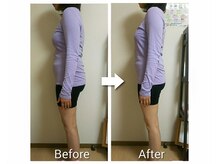 キラリ(Kirari)/ゆがみ矯正で姿勢美人に♪