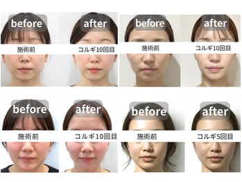 サロンドエチュール(Salon de ETULE)/BeforeAfter