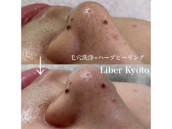 リベルキョウト 京都駅前店(Liber Kyoto)/毛穴レス艶肌コース