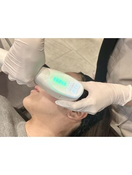 シミしわ改善！予防ケア