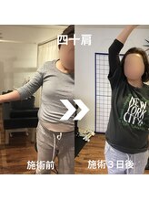 からだサロン サニー 堺東(SUNNY)/肩の痛み