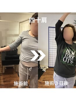 からだサロン サニー 堺東(SUNNY)/肩の痛み