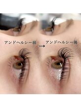 リュイールアイ(LUIRE eye)