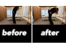 腰痛特化整体院 山本/慢性腰痛before　after