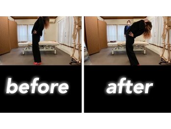 腰痛特化整体院 山本/慢性腰痛before　after