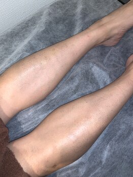 シド/剛毛 すね毛 二回目