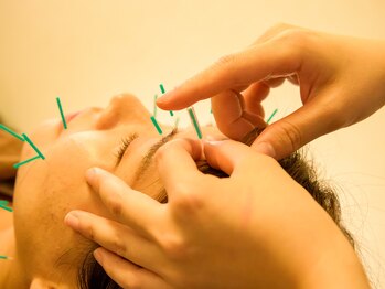 メディカルスパ みなとみらい鍼灸院/美容鍼施術