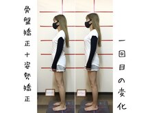 三輪整体院 鍼灸マッサージ院/驚きのbefore→after