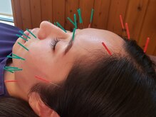 栄光治院 岡崎本院/肌にお悩みの方へ