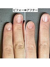 桃の木 吉祥寺店/再来におすすめ！通常ネイルケア