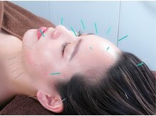 ビビオンリーワン 銀座築地(vivi only one)/vivi美容鍼コース