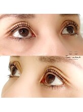 トワメム 自由が丘(Toi-meme)/まぶたもしっかりリフトアップ♪