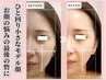 ★【歪み/エラ/面長/非対称】Ritz式小顔矯正+頭蓋骨+首肩デコルテ￥11500