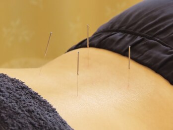 小笠原鍼灸接骨院/整体・もみほぐし［所沢］