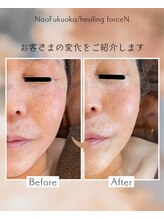 ナオフクオカ ヒーリングフォースエヌ(NaoFukuoka/healingforceN)/今までケアした事ないマダムも！