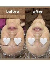 ウォームメモリー(warmmemory)/フェイシャルエステ