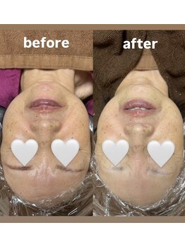 ウォームメモリー(warmmemory)/フェイシャルエステ