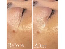 MMK/目元が変わるだけでマイナス5歳!