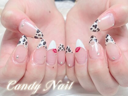キャンディーネイル(candy nail)の写真