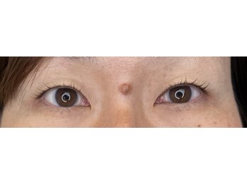 アールエム(Rm)/6月◇まつげ