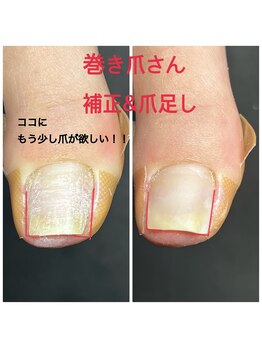ルアナネイル(Luana Nail)/補正+爪足し