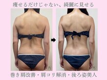 プラスワンビューティテン 新大阪店(Plus One Beauty)の雰囲気（痩身施術効果：ダイエット/脂肪燃焼/疲労回復/むくみ/引き締め）