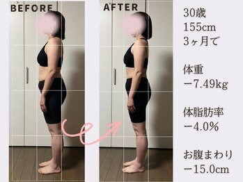 香林(KARIN)/ビフォーアフター