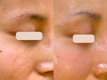 アン(An)の雰囲気(シミ、年齢が気になる肌悩みに【プラズマ肌質改善】)