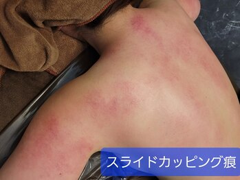 ティティビューティ ラ・クエージ金山(TTBeauty)/悶絶!爽快☆スライドカッピング