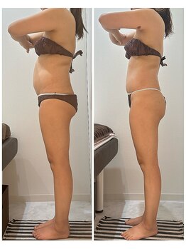 グッドライフエステ/3,お写真で結果を確認