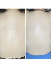 ラ ジェム(La gemme)/【６、７、8月セール】