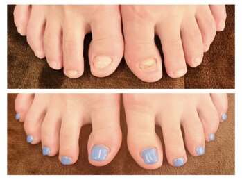 グレースレディ 大阪店/(深爪/長さだし/フィルイン