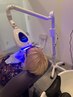 【セルフホワイトニング】簡単時短で輝く笑顔に！30分