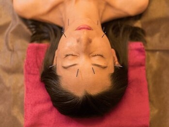 肩甲骨ほぐしのしみず堂 阿佐ヶ谷分院の写真/大注目の鍼灸メニューがついにスタート！日々の疲れを癒しながら、美容鍼でフェイシャルケア＆リフトアップ