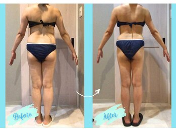 千歳の女神 西尾本店/【施術風景】Before/After