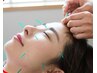 【顔まわりが気になる方へ】お悩みに合わせて受けられるおまかせ美容鍼