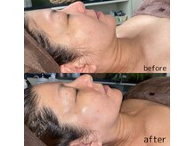 アクアガーデン(Aqua Garden)の雰囲気（ハイパー小顔フェイシャル♪）