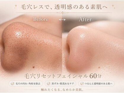 セレソル(CERESOL)の写真