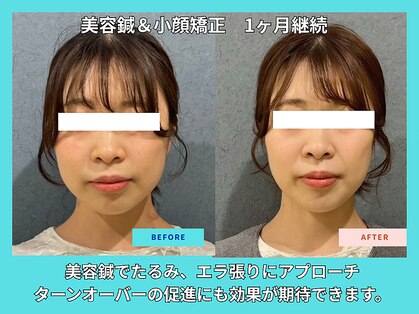 晴々の写真