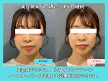 晴々