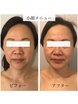 スナオ(sunao)/究極小顔メニュー♪30代女性