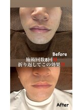 ケアアネラ(KeaAnela)/男性必見！